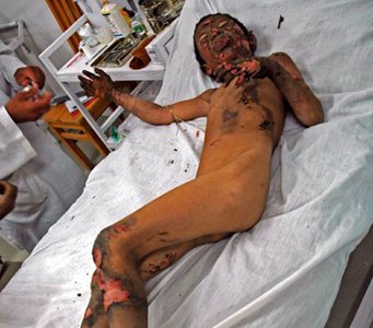 NATO victim in Lashkargah