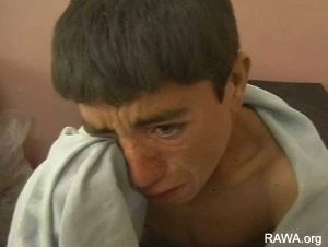 Young wounded boy in the hospital