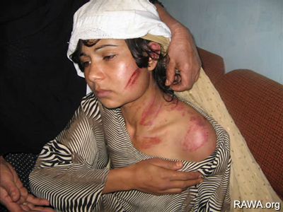 Violence against women is widespread all over Afghanistan.