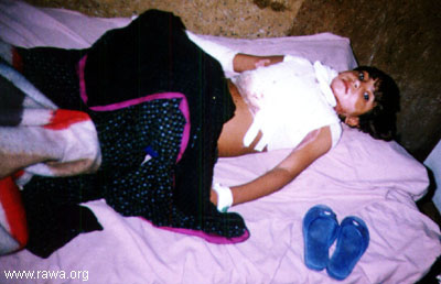 Wounded child in Jalalabad