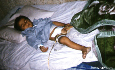 Wounded child in Jalalabad