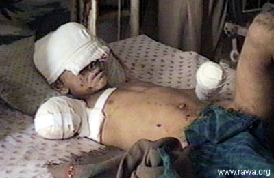 Victims of the US strikes in Jalalabad