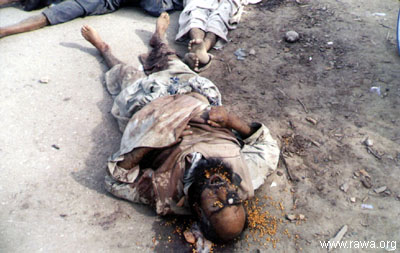 Wounded child in Jalalabad