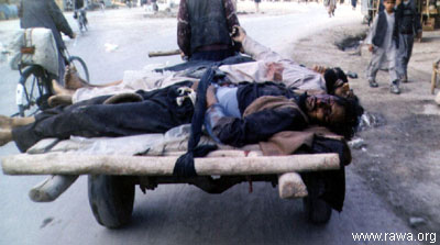 Wounded child in Jalalabad