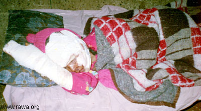 Wounded child in Jalalabad