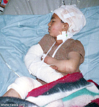 Wounded child in Jalalabad