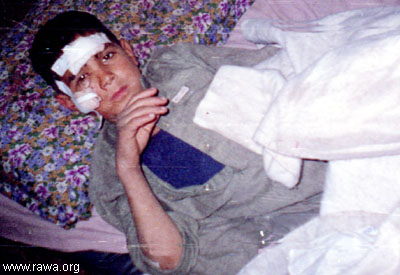 Wounded child in Jalalabad