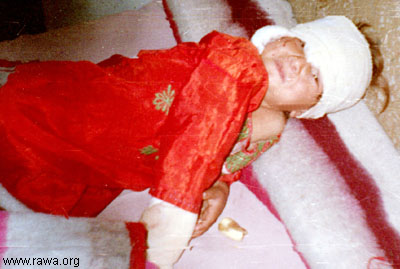 Wounded child in Jalalabad