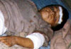 A child wounded in Jalalabad due to US bombardment of residential areas