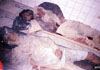 2 out of tens of civilians killed in by the US bombs laying in a hospital in Jalalabad