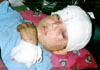 A child wounded in Jalalabad due to US bombardment of residential areas